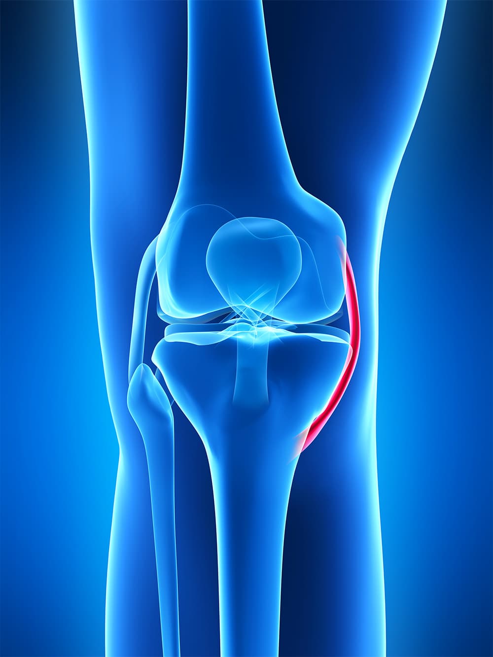 Schema décriptif du ligament collatéral médial du genou