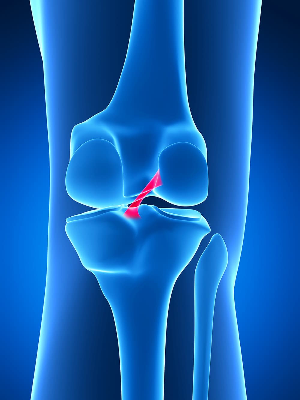 Schema descriptif du ligament croisé antérieur